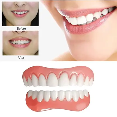 Realistic Simulated Teeth Veneers, Photography Props