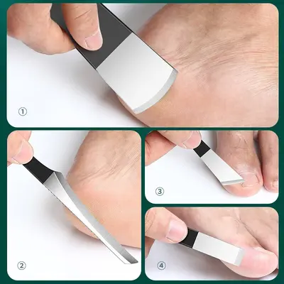 Professionelles Pediküre-Set mit Nagelschere, Hornhaut- und Hähnchenauge-Entferner