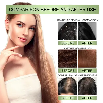 OUHOE Herbal Hair Oil, Gentle Moisturizing, Strengthening Lightweight Care Oil