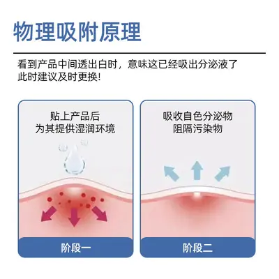 水胶体痘痘贴 紫外线吸脓轻薄透气祛痘贴源头工厂支持定制