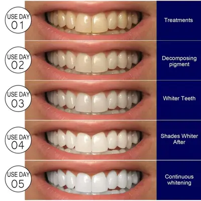 跨境爆款美白牙贴口腔护理高效焕白Teeth Whitening Strips牙贴