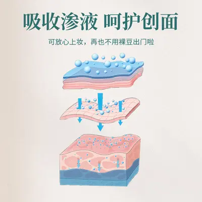 Star-Shaped Acne Patches, Thin, Breathable and Waterproof - 4