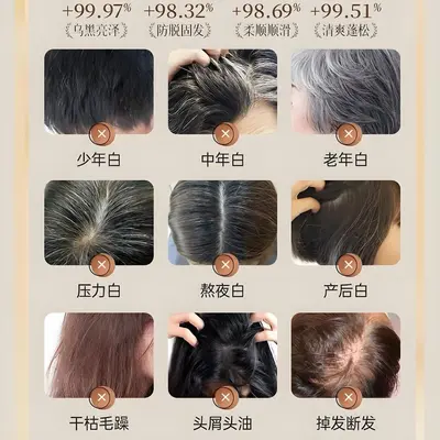 白转黑乌黑滋养液精华液滋养毛囊坚韧发根育发防脱发何首乌育发液 - 5