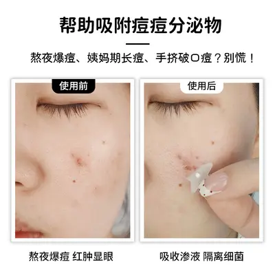 厂家批发水胶体精油款痘痘贴防水情绪气泡精油款遮痘贴上妆人工皮