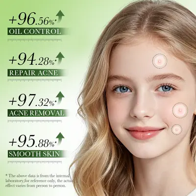 Полный английский пластырь от акне SADOER Teen Salicylic Acid Centella Acne Patch Fades Acne Marks Whiteheads Blackheads Cross-border