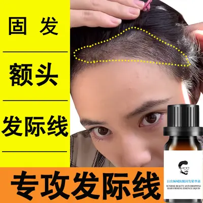 Saç Çizgisi Büyütücü Serum Saç Besleyici Bakım Sıvısı Dökülme Önleyici Yoğunlaştırıcı Sıvı Saç Bakım Yağı Kafa Derisi Serumu Saç Çıkarıcı Ürün