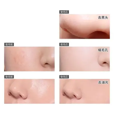 竹炭去黑头鼻贴撕拉式收缩毛孔粉刺深层清洁面膜控油男女专用批发
