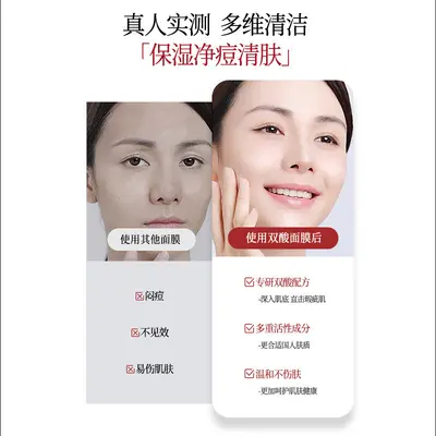 SEEK KITI Double Acid Acne Mask Oil Control and Blackhead Removal