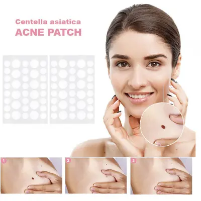 Ultra-Thin Invisible Acne Patches, Acne Mark Concealing, Strong Absorbing - 5