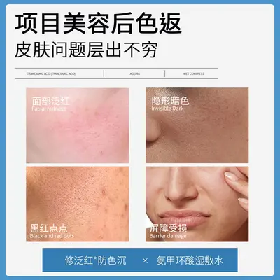 Tranexamic acid 5% wet compress essence with nicotinamide for external use, tranexamic acid original formula to improve dullness and brighten skin tone