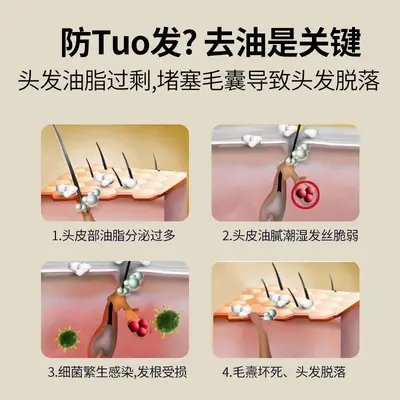 香港老瑶姜洗发水姜米酵素精华去屑控油洗发露滋养沐浴露720ml - 4