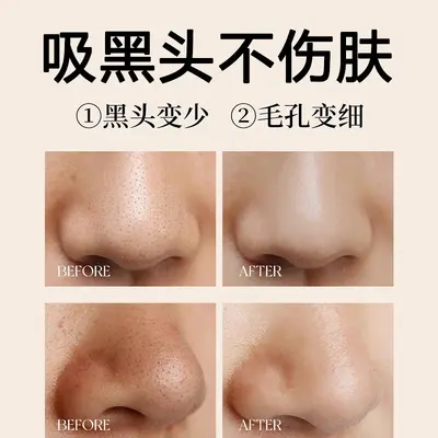 去黑头鼻贴套盒T区祛粉刺收缩毛孔黑头导出液去黑头的鼻贴鼻头贴