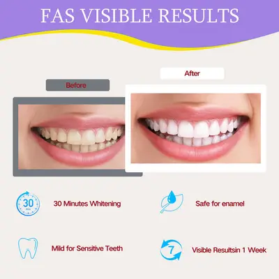 Teeth Whitening Strips for Gentle Daily Tooth Care - 4