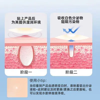 跨境源头厂家水胶体痘痘贴面膜强效吸浓隐形超大号熬夜神器 独立