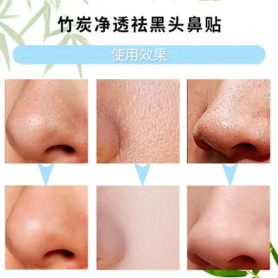 Bamboo Charcoal Blackhead Nose Strips, Gentle Pore Cleansing - 3