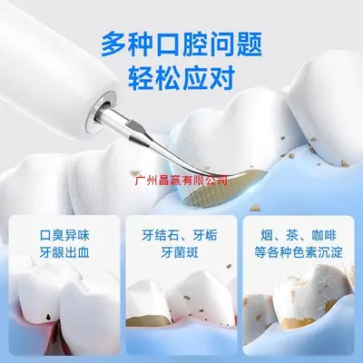 超声波洁牙器牙结石专业去除器冲牙清洁牙齿结石污垢洗牙家用新款