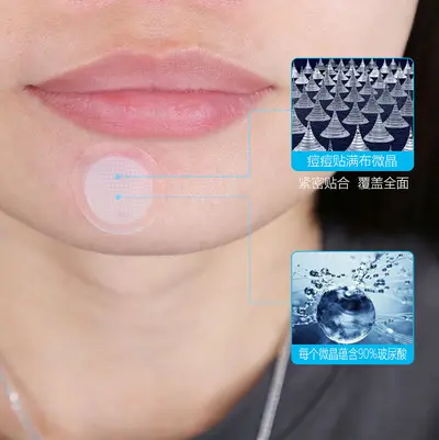 定制微晶痘痘贴玻尿酸水胶体痘痘贴可溶性微晶痘痘贴痘痘贴oem