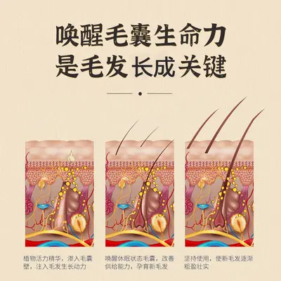 育发液增发密发防脱修护发根浓密发际线生长剂护发植物提取液厂家