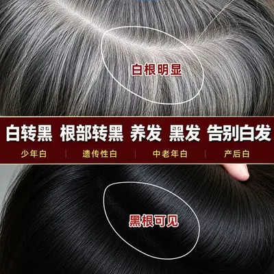 白转黑精华液乌黑滋养液滋养毛囊坚韧发根育发液防脱膏何首乌草本 - 2