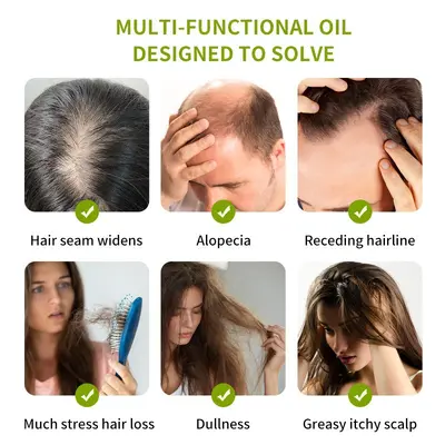 Anti-Haarausfall-Haaröl für langes Haar - 4