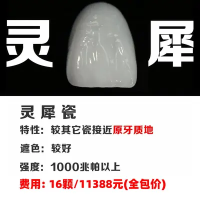 Full Porcelain Dental Veneers, Domestic Porcelain Tooth Veneer Patches - 12