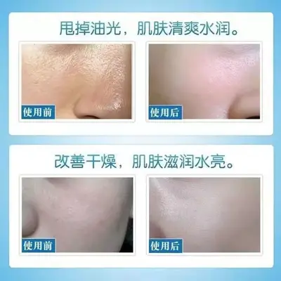 不挂网玻尿酸原液次抛补水保湿提亮肤色收毛孔精华液安瓶正品批发