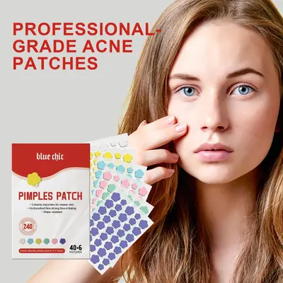 Gentle Non-Irritating Acne Patches for Blemish and Blackhead Fading - 4