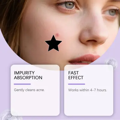 JAYSUING Star-Shaped Acne Patch for Covering Facial Blemishes