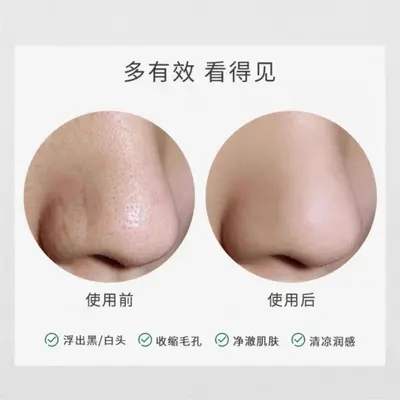 Herisse Tea Tree Blackhead Remover Extract Trilogy Set Nose Patch Nose Mask Blackhead Export Liquid Pore Shrinking Cleansing - 4