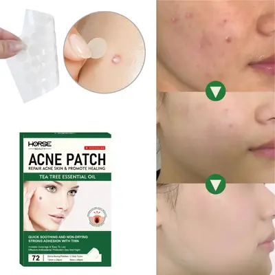 Unsichtbare Akne-Patches, 72 Stück