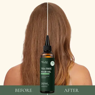 Tea Tree Hair Care Oil 150ml, Reduces Frizz and Split Ends