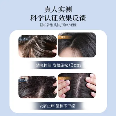 金鸡纳去屑洗发水控油蓬松去屑止痒头皮净化改善毛躁香味持久洗发