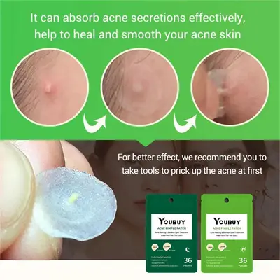 Cross-border Youbuy acne patch 36 capsules hydrocolloid invisible acne patch day and night invisible patch acne patch