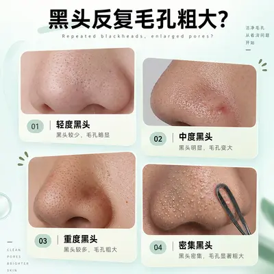 Jingtian White Tea Blackhead Remover Nose Strip Set Essence Nose Mask Gentle Pore Cleansing Oil Control Pore Shrinking Wholesale