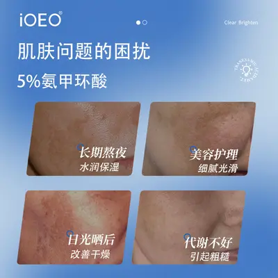 iOEO Tranexamic Acid 5% Essence Liquid improves dry skin, moisturizes and softens skin, wholesale dropshipping.