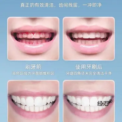 超声波冲牙器家用便携式洗牙器洁牙器水牙线正畸专用