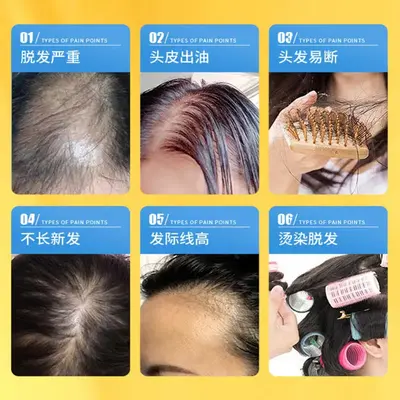 Nanjing Tongrentang Handa Anti-Haarausfall-Ingwer-Shampoo - 4
