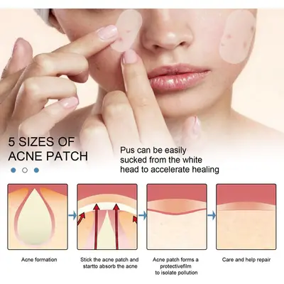 EELHOE Acne Patch, Gentle, Breathable, Portable Facial Care Patch - 4