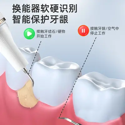 超声波电动洁牙器牙结石去除器牙垢清洁冲牙洗牙器美牙仪续航强劲