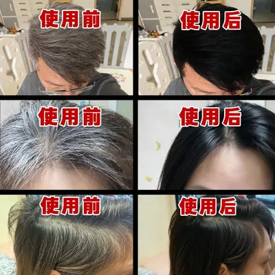 White to Black Hair Essence Polygonum Multiflorum