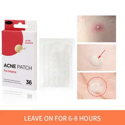 Патчи от прыщей для внешней торговли через границу ACNE PATCH Full English Portable Patch Hydrocolloid Acne Pimple Patch Custom - 4