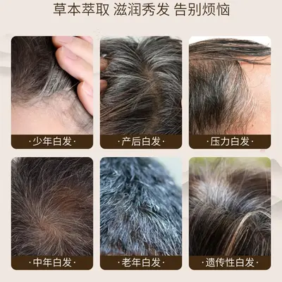 何首乌白发转黑发精华液滋养毛囊营养液生长发液防脱精华乳育发液 - 7