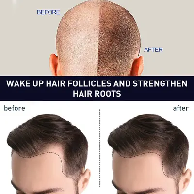 OUHOE Bitkisel Saç Serum Yağı, Parlaklık ve Yumuşaklık - 5