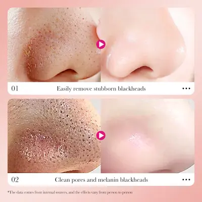 SADOER Bamboo Charcoal Nose Strips for Deep Pore Cleansing - 6