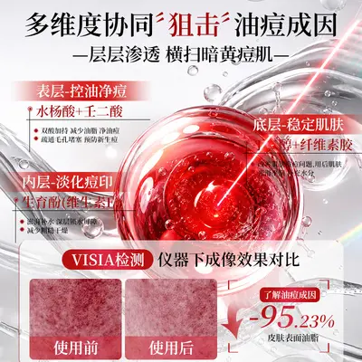 Gebaolian Invisible Acne Patch 72 Pieces, Day and Night Pimple Absorbing - 5
