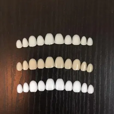 Ready-Made Whitening Tooth Veneers for Upper and Lower Jaw, Unisex - 4