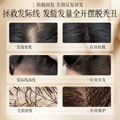 防脱固发洗发水 生姜侧柏叶何首乌养发护发洗发露国妆特字洗头膏 - 4
