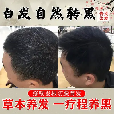 白转黑乌黑滋养液精华液滋养毛囊坚韧发根育发防脱发何首乌育发液 - 2
