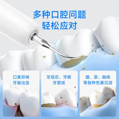 跨境便携冲牙器洗牙器去牙结石家用智能识别保护牙龈超声波洗牙仪