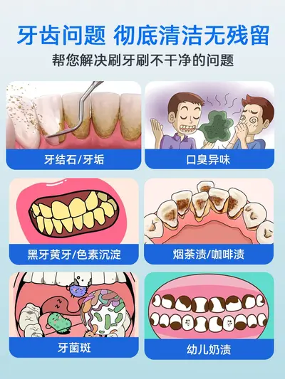 超声波洁牙器牙结石专业去除器冲牙清洁牙齿结石污垢洗牙家用新款 - 10